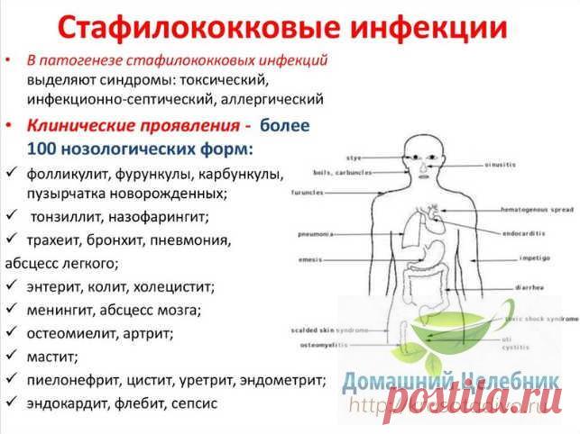 Стафилококк боится череды и эвкалипта: народное лечение стафилококковых инфекций на коже и слизистых На сегодняшний день насчитывают уже 27 разновидностей стафилококка. Примерно 14 различных видов стафилококка постоянно находятся на коже и слизистых оболочках человека.

Например, эпидермальный стафил…