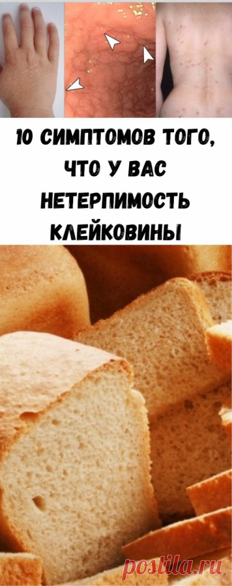 10 симптомов того, что у вас нетерпимость клейковины - Полезные советы красоты
