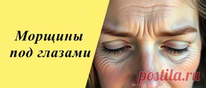 Морщины под глазами: как убрать в домашних условиях Советы и методы борьбы с морщинами под глазами. Узнайте о причинах их появления и эффективных способах ухода за кожей для поддержания молодости.