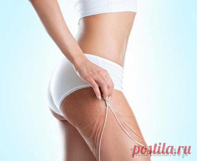 Процедуры и рецепты средств с солью от растяжек В статье обсуждаем возможности борьбы с растяжками при помощи морской соли. Мы расскажем об основных косметических процедурах с солью от растяжек, представим различные народные рецепты, а также привед...