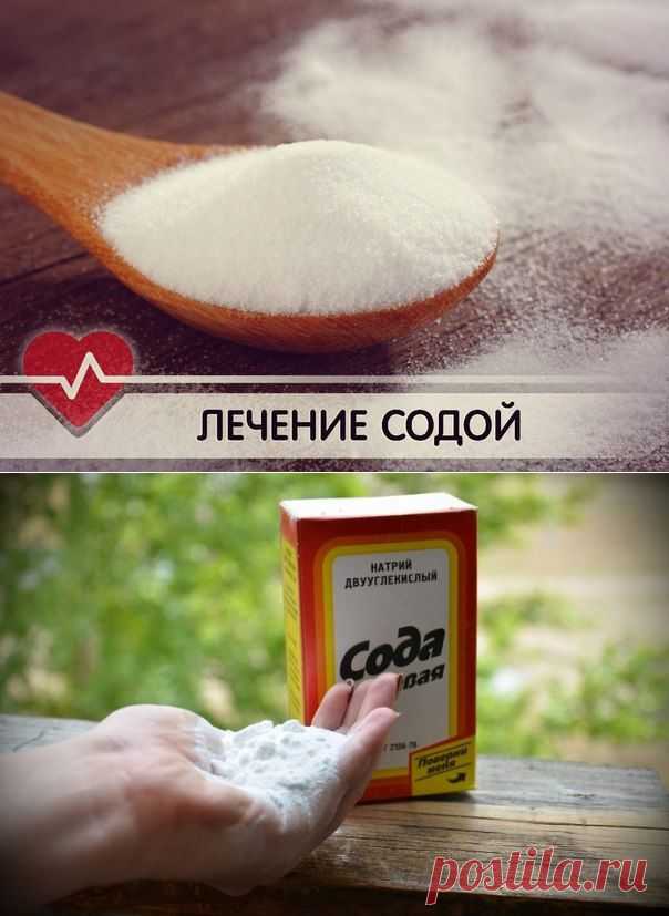 18 РЕЦЕПТОВ ЛЕЧЕНИЯ ПИТЬЕВОЙ СОДОЙ!