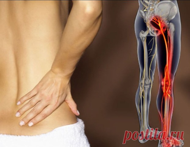 КАК РАЗБЛОКИРОВАТЬ СЕДАЛИЩНЫЙ НЕРВ
Как разблокировать седалищный нерв: 2 простых способа снять боль
Седалищный нерв свое начало берет в поясничном отделе позвоночника и, проходя через ягодицы, тянется к ступне. Поэтому боль при его защемлении чувствуется особенно сильно. 
Как правило, термин «защемление/ущемление седалищного нерва» подразумевает потерю эластичности и гибкости мышц задней поверхности ноги. Это часто связано с процессом возрастного укорочения (ригидности) мы...