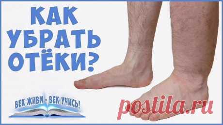 Как убрать такие отёки?