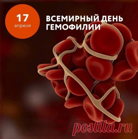 17 апреля, мы отмечаем Всемирный день гемофилии! Желаем всем пациентам и их близким стойкости, оптимизма и самого крепкого здоровья. Открытки на Всемирный день гемофилии!