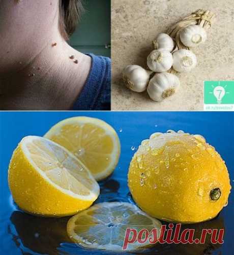 Чеснок против папилом и другие рецепты