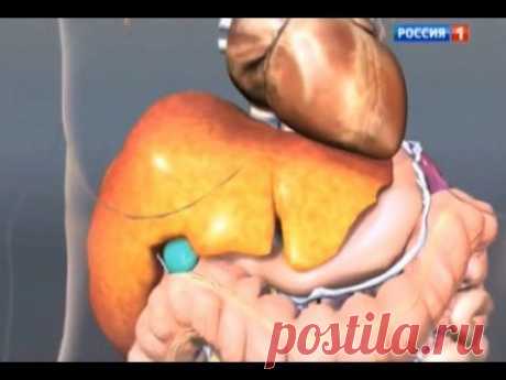 Гепатит «А». Симптомы и как уберечь себя | Подружки