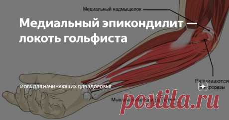 Медиальный эпикондилит — локоть гольфиста Статья автора «Йога для начинающих для здоровья» в Дзене ✍:  Медиальный эпикондилит, широко известный как "локоть гольфиста", представляет собой воспалительное поражение сухожильных прикреплений...