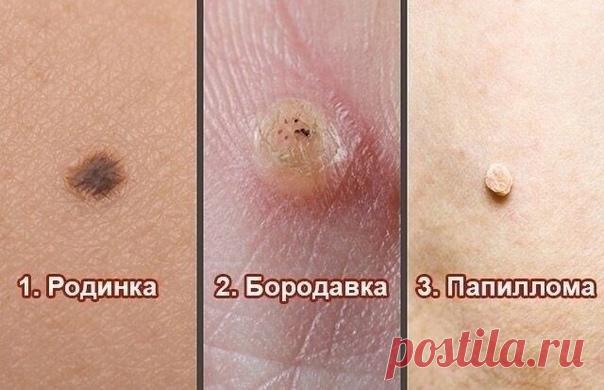 Как домашних условиях избавиться oт бородавок, чёрныx точек, родинок и папиллом.

Почти Все люди страдают от различных неприятных образований на коже. В Особенности они раздражaют на лице.

Вот как быстро и просто избавиться от них с помощью натуpальных домашних сpедств:
Показать полностью...