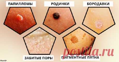 Вот как избавиться от угрей, черных точек и бородавок не выходя из дома
К сожалению, проблемная кожа — это напасть, не зависящая от возраста, пишет Providr. Это может быть следствием гормональных изменений, а может быть вызвано болезнью или дефицитом каких-нибудь веществ в организме. Бывает также, что вам просто хочется избавиться от накожных образований по чисто эстетической причине. Лучший...
Читай пост далее на сайте. Жми ⏫ссылку выше