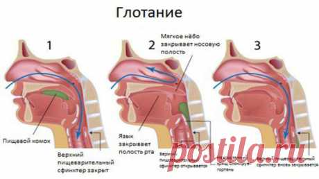 Первая помощь если что-то застряло в горле — прием Геймлиха — Полезные советы