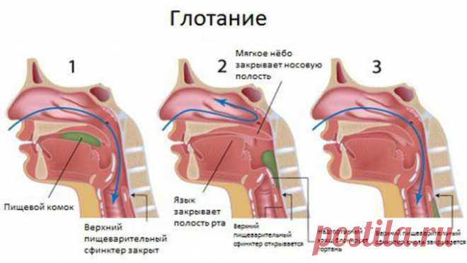 Первая помощь если что-то застряло в горле — прием Геймлиха — Полезные советы