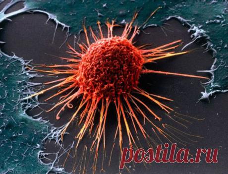 Двенадцать мифов официальной онкологии