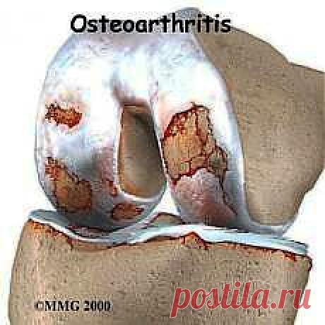 Народные методы лечения | Записи в рубрике Народные методы лечения | Дневник КРАСОТА_ЗДОРОВЬЯ