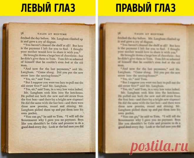 Первые признаки рассеянного склероза, о которых стоит знать не только людям в возрасте