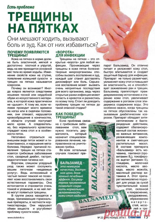 Трещины на пятках