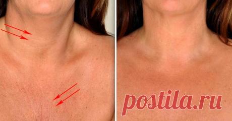 Применяй эти 4 ингредиента и кожа шеи и декольте будет, как в 20 лет! Избавься от морщин и складок на шее и декольте быстро и просто! Удивительные результаты!Морщины на шее и в области декольте появляются раньше, чем на коже лица и поэтому стоит уделять им больше вн