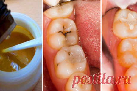 Эта маска для зубов оставит стоматологов без работы! Всего 4 компонента… | Милая Я К сожалению, кариес является самой распространенной проблемой, поражающей зубы. Этот процесс разрушения зубной эмали часто сопровождается сильными болевыми ощущениями. Сегодня наша редакция поделится с тобой рецептом замечательного средства, которое поможет предотвратить и остановить развитие этой болезни. Но не стоит думать, что, используя лишь это средство, ты навсегда забудешь о проблемах...
