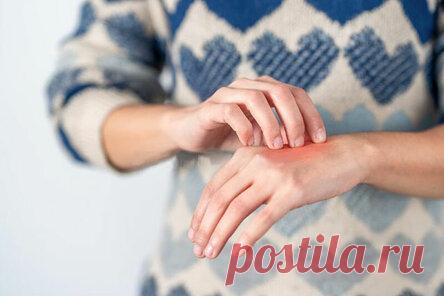 Народная медицина и атопический дерматит