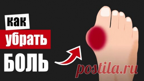 Косточка на ноге: упражнения от боли и деформации сустава | Здоровьесберегающий канал | Дзен