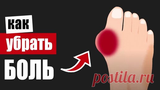 Косточка на ноге: упражнения от боли и деформации сустава | Здоровьесберегающий канал | Дзен