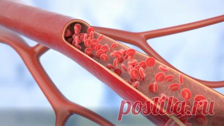 Какие продукты очищают кровь? Можно ли очистить кровь и как в этом поможет питание?