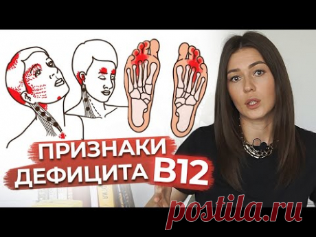 Проблемы с памятью? / Чем опасен дефицит витамина В12? / Лучшие источники витамина В12