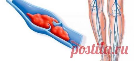 Эффективное средство от тромбов в сосудах | Polza-vred.su