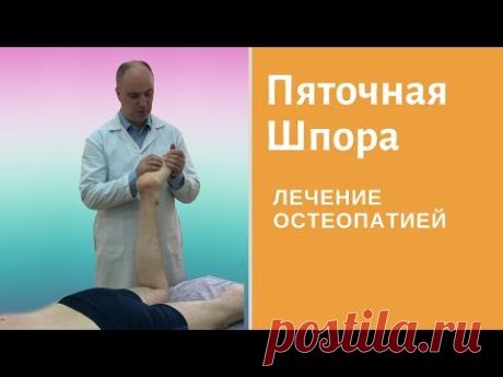 Что такое пяточная шпора или плантарный фасциит? Остеопатия при пяточной шпоре и боли в пятке