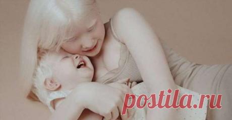 Теплые фотоснимки сестренок-альбиносок из Казахстана растопят ваше сердце | Люблю Себя