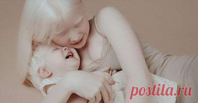 Теплые фотоснимки сестренок-альбиносок из Казахстана растопят ваше сердце | Люблю Себя