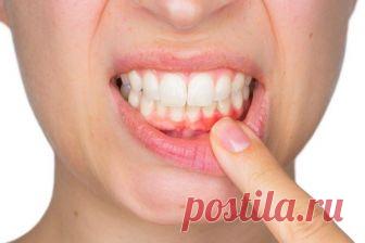 Чем и как БЫСТРО лечить флюс в домашних условиях и снять опухоль с десны и щеки | Традиционные и народные методы лечения