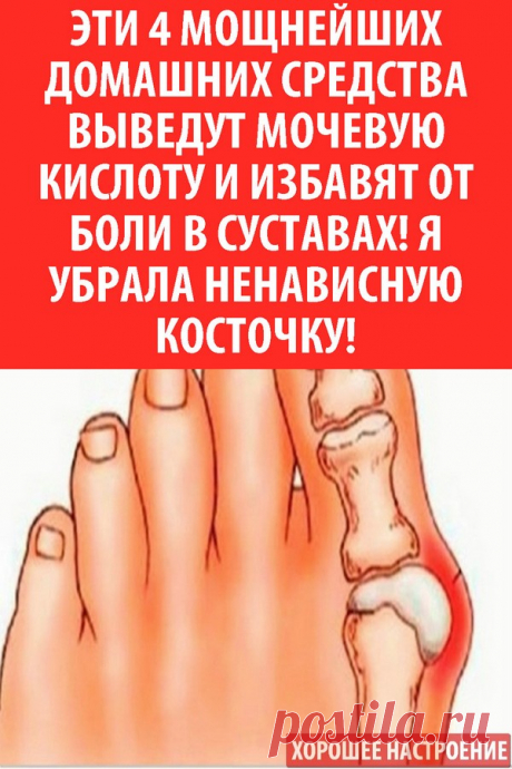 Эти 4 мощнейших домашних средства выведут мочевую кислоту и избавят от боли в суставах! Я убрала ненависную косточку!