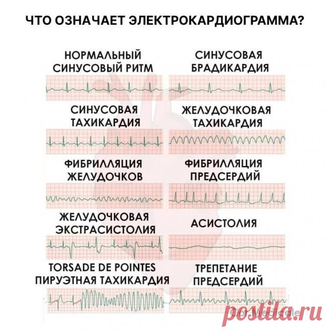 hmvGiclrcec.jpg (768×768)