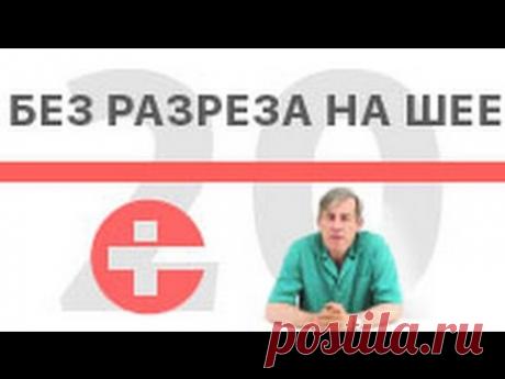 Эндоскопическая операция на щитовидной железе