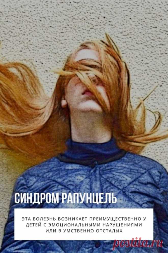 Синдром Рапунцель — это термин означает необычную форму безоара («волосяной шарик»), которая имеет хвостообразное расширение и распространяется от желудка до тонкой кишки или далее, таким образом вызывая закупорку желудочного выхода. Название синдрома происходит от одноименной сказки братьев Гримм о принцессе, которая была заперта в высокой башне без лестницы и дверей и имела очень длинные золотистые волосы, с помощью которых колдунья, что с ней жила взбиралась наверх.