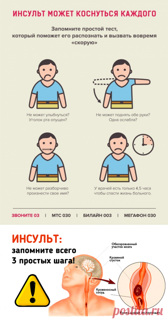 ИНСУЛЬТ: Запомните 3 простых шага, чтобы спасти жизнь себе или близким!
