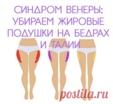 Синдром Венеры: убираем жировые подушки на бедрах и талии Синдром Венеры - таким термином обозначается образование жировых подушек, снижение упругости мышц на бедрах и талии.