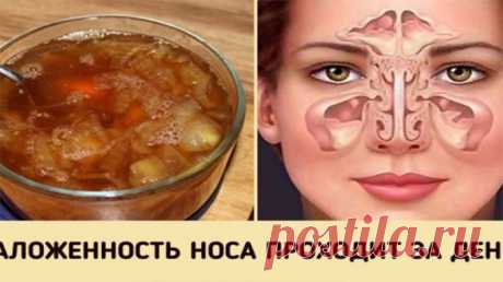 Супер-средство от заложенного носа. Будете свободно дышать уже на утро!