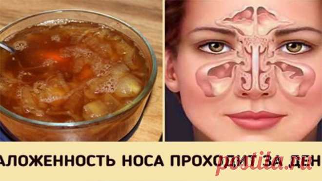 Супер-средство от заложенного носа. Будете свободно дышать уже на утро!