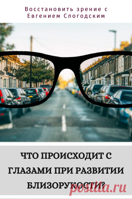 Близорукость у детей и взрослых чем опасна Миопия Коррекция зрения лечение без операции профилактика признаки причины степень диагностика последствия как вылечить Улучшить зрение прогрессирующая близорукость очки линзы Плохое зрение Упражнения зарядка при миопии глаз тренажёр Как вернуть восстановить исправить зрение Может ли миопия привести к слепоте Проверка остроты зрения Капли для улучшения зрения Возможно ли вылечить миопию Зрительный режим для детей Снижение зрения Перифокальные очки