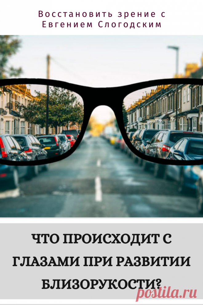 Близорукость у детей и взрослых чем опасна Миопия Коррекция зрения лечение без операции профилактика признаки причины степень диагностика последствия как вылечить Улучшить зрение прогрессирующая близорукость очки линзы Плохое зрение Упражнения зарядка при миопии глаз тренажёр Как вернуть восстановить исправить зрение Может ли миопия привести к слепоте Проверка остроты зрения Капли для улучшения зрения Возможно ли вылечить миопию Зрительный режим для детей Снижение зрения Перифокальные очки