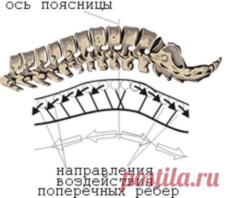 Профилактика и лечение остеохондроза.