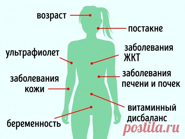 10 средств для кожи, которые стирают пигментные пятна как ластик Основными причинами возникновения пигментных пятен могут быть воздействие ультрафиолетового излучения, возрастные изменения, хронические заболевания печени и почек, последствия акне, беременность, заб...