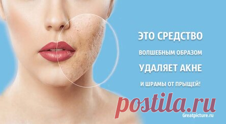 Это средство волшебным образом удаляет акне и шрамы от прыщей