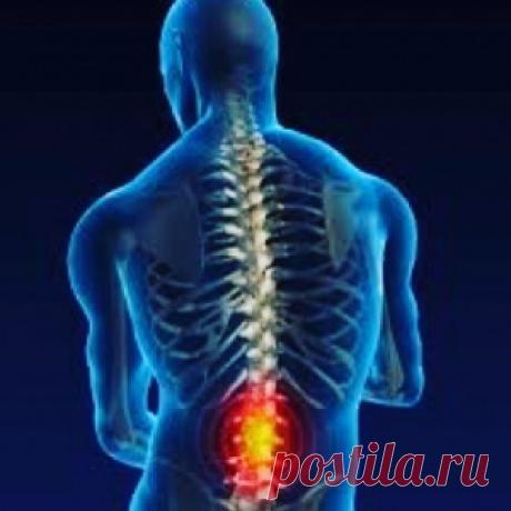 Лечение межпозвоночной грыжи народными методами - МирТесен
