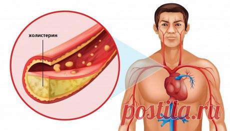 Как снизить холестерин в крови в домашних условиях быстро и эффективно Проблема холестеринового обмена в последнее время является одной из ключевых моментов в сохранении здоровья современного человека. Нарушение количественного состава липопротеинов различной плотности в крови и вызывает массу хронических заболеваний, которые постепенно приводят к преждевременной смерти. В настоящее время разработано множество медикаментов, которые нормализуют холестериновый обмен и снижаю...