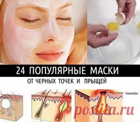 24 ПОПУЛЯРНЫЕ МАСКИ ОТ ЧЕРНЫХ ТОЧЕК И ПРЫЩЕЙ!