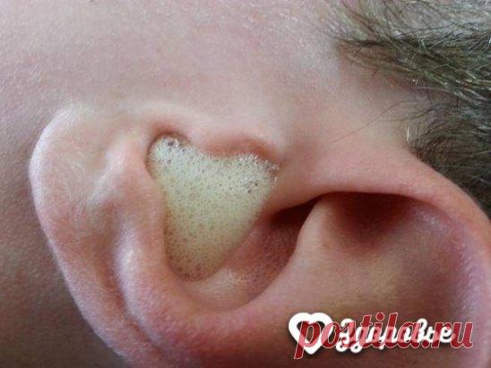 Все говорят, что перекись полезна, но вот чего они не говорят… 
Перекись водорода не только отлично поможет вам отмыть ванну, туалет, кафель, холодильник и т. д., не только дезинфицирует застоявшуюся воду, хлебницу, посуду и т. п. — но и найдёт применение как косметическое, медицинское и даже кулинарное применение!