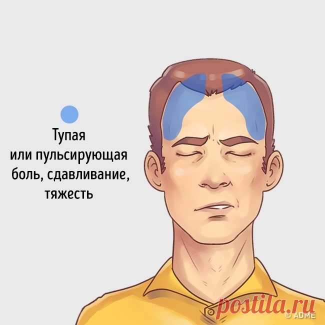 5 типов головной боли и способы быстро от них избавиться