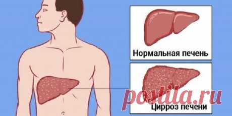 Мы травим свою печень одним привычным продуктом! Настоящая гадость Даже самый лучший растворимый кофе — совсем не тот продукт, который нужно употреблять ежедневно. Определить, пьешь ты что-то хорошее или яд, чрезвычайно легко. Капни несколько капель йода в кружку с только что приготовленный напитком.
Если ты увидишь, что растворимый кофе приобрел синеватый оттенок
